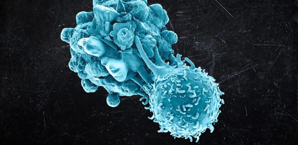 Cancer Survivors