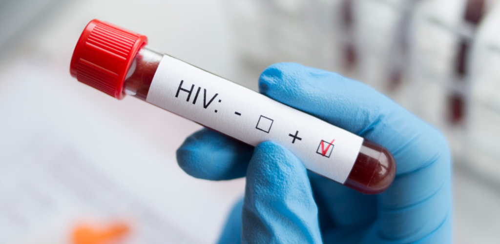 hiv_testing_day